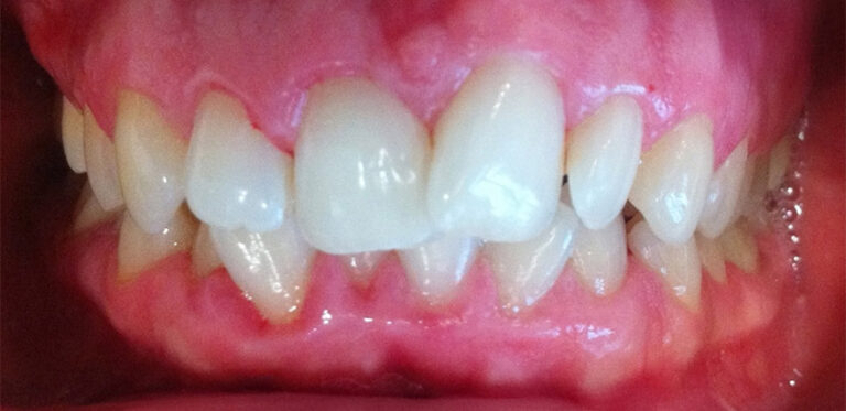 Metamorfoza 01 - przed