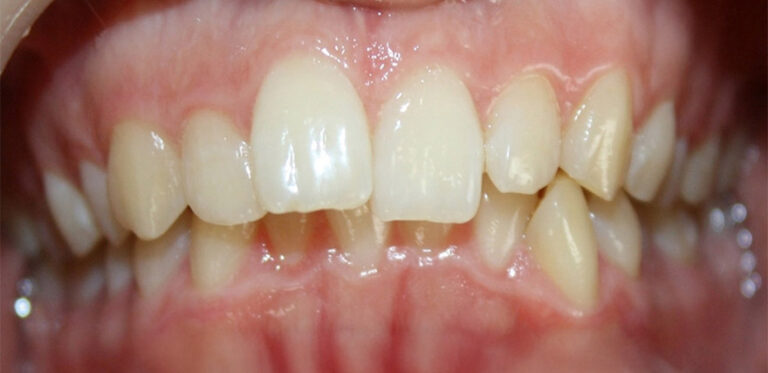 Metamorfoza 03 - przed