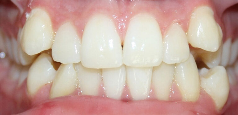 Metamorfoza 05 - przed