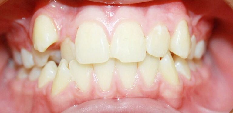 Metamorfoza 06 - przed