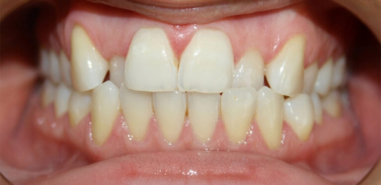 Metamorfoza 07 - przed