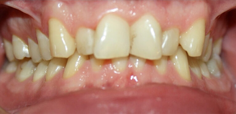 Metamorfoza 08 - przed