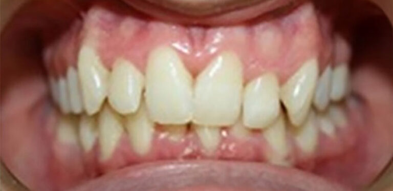 Metamorfoza 09 - przed